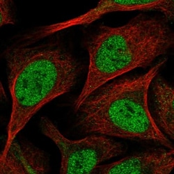 SORBS2 Antibody, Novus Biologicals:Antibodies:Primary Antibodies